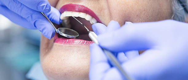 Best Emergency Dentist for Knocked-Out Tooth in Saddle Rock, NY